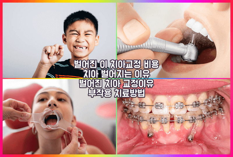 벌어진 이 치아교정 비용
